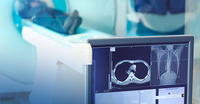 Caror pacienti li se recomanda examinarea Computer Tomograf (CT) dupa infectia COVID-19? Caror pacienti li se recomanda examinarea Computer Tomograf (CT) dupa infectia COVID-19?